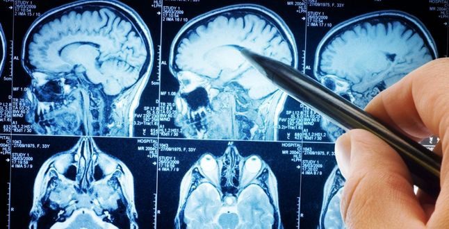 Cuatro alimentos que, según los expertos en cáncer, se deben evitar ➤ Globenow.info