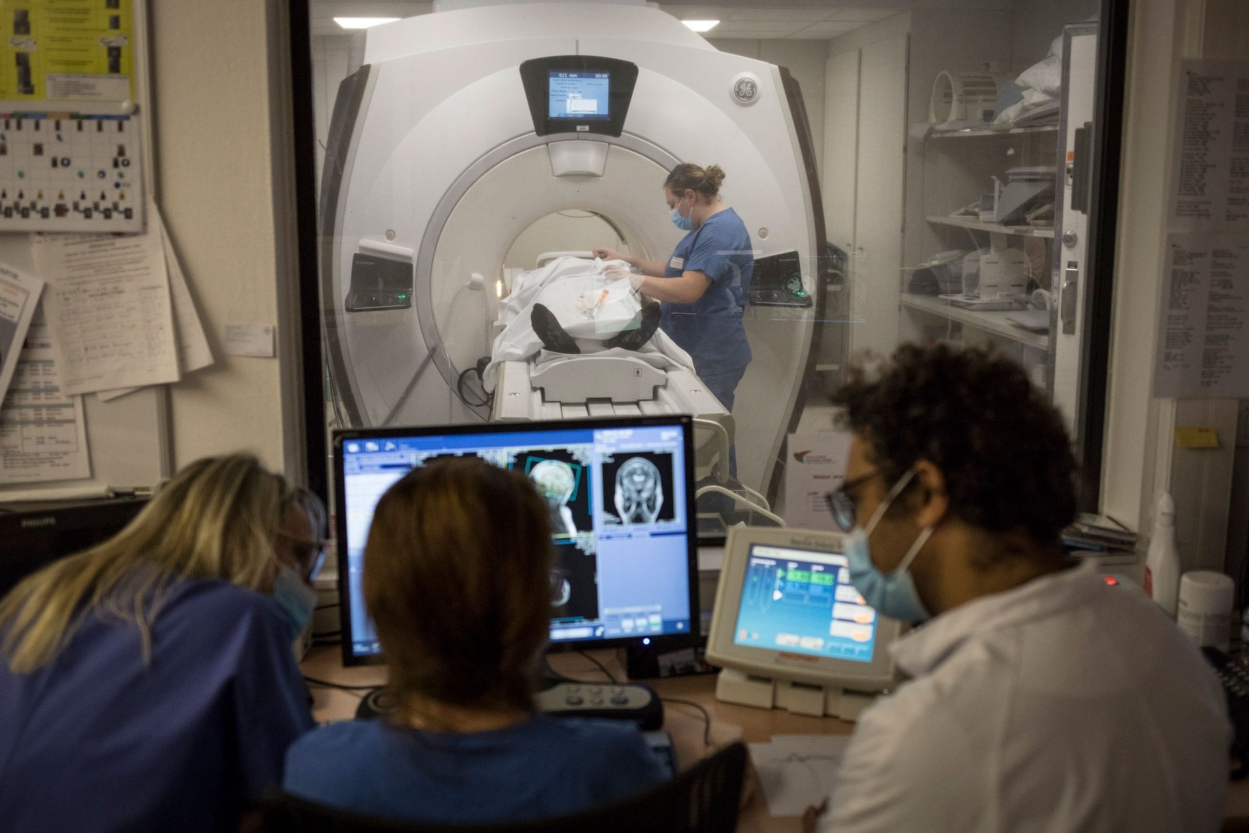 Wissenschaftler schlagen Alarm: Was passiert nach einer COVID-19-Infektion mit dem Gehirn?