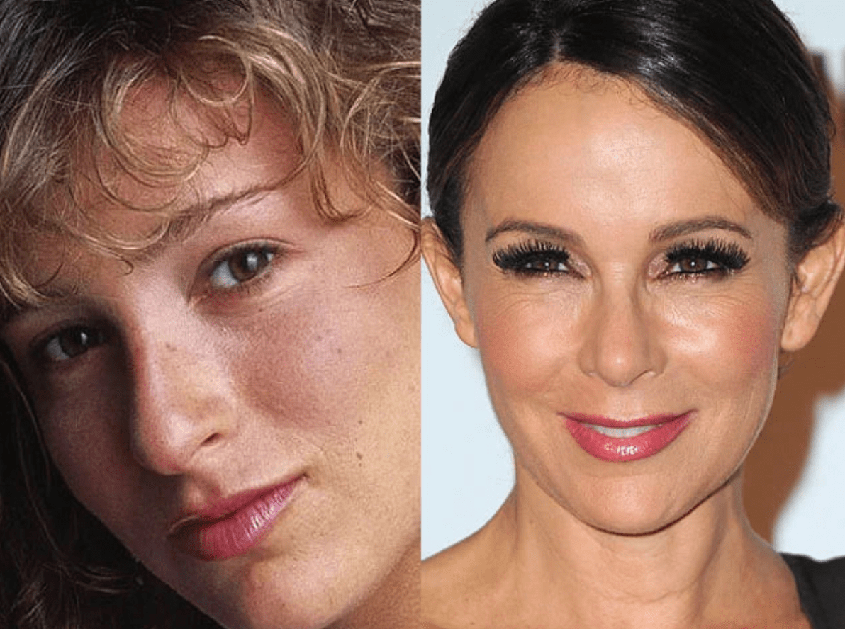 Celebridades cuyas cirugías plásticas causaron sensación: Lo que dicen los expertos