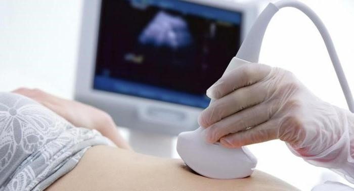 Pensó que su embarazo había terminado. Pero tres semanas después, los médicos descubrieron algo inimaginable