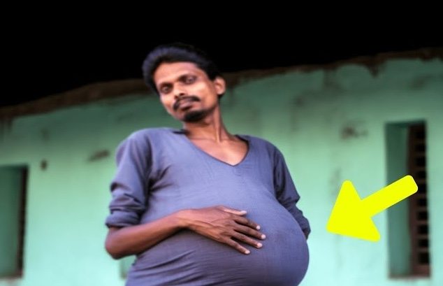 Eine routinemäßige ärztliche Untersuchung wurde zu einem Ereignis, das Rohan Agarwals Leben für immer verändern sollte